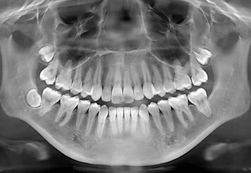 КТ зубов в Витебске: Расширяя Горизонты Стоматологической Диагностики