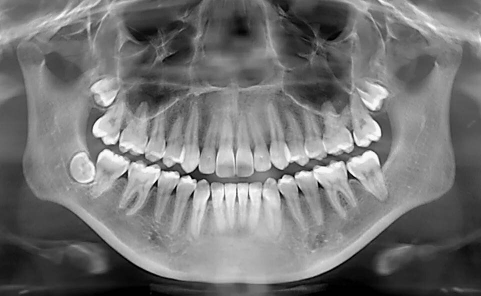 КТ зубов в Витебске: Расширяя Горизонты Стоматологической Диагностики